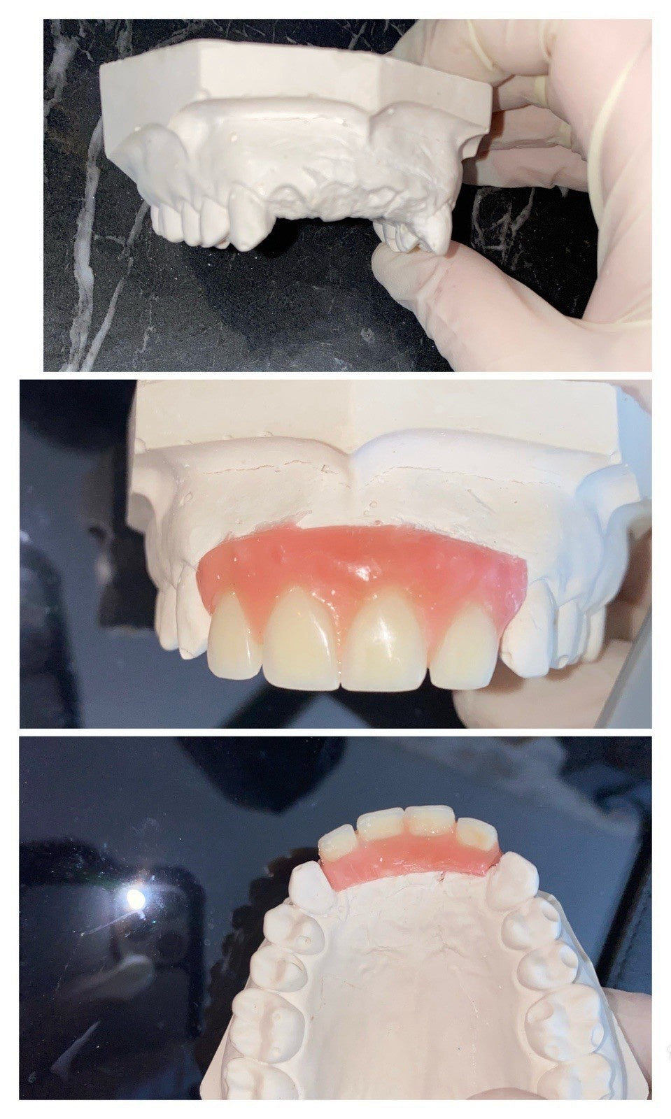 DIY Denture Shop DIY Partial Or Full Denture New