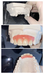 DIY Denture Shop DIY Partial Or Full Denture New